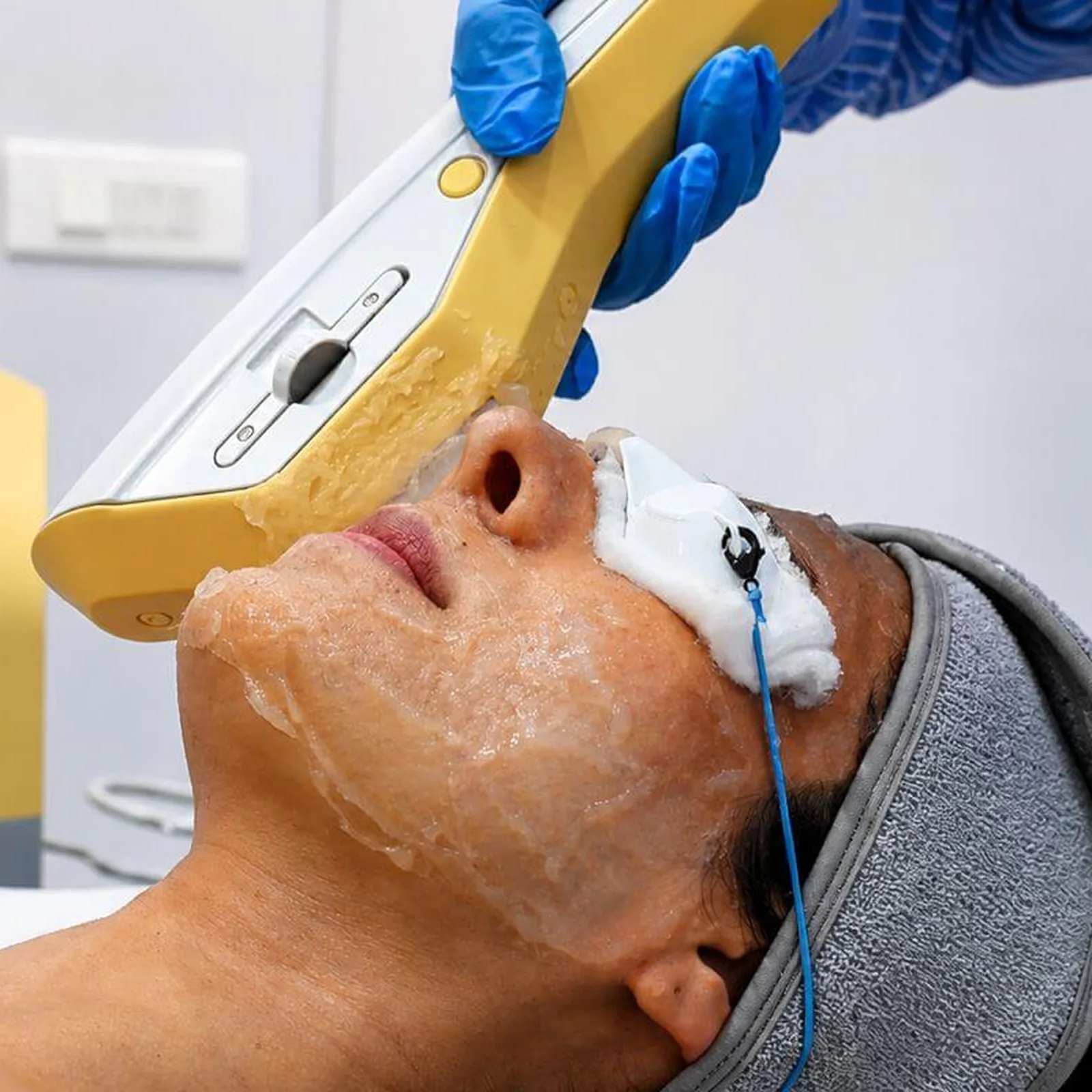 BTL Exilite IPL platform