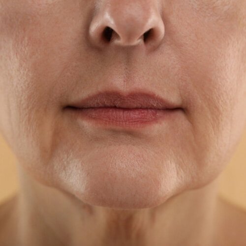 Mediglo - Skin Aesthetics and Advanced Wellness Clinic 16 After Skin 1