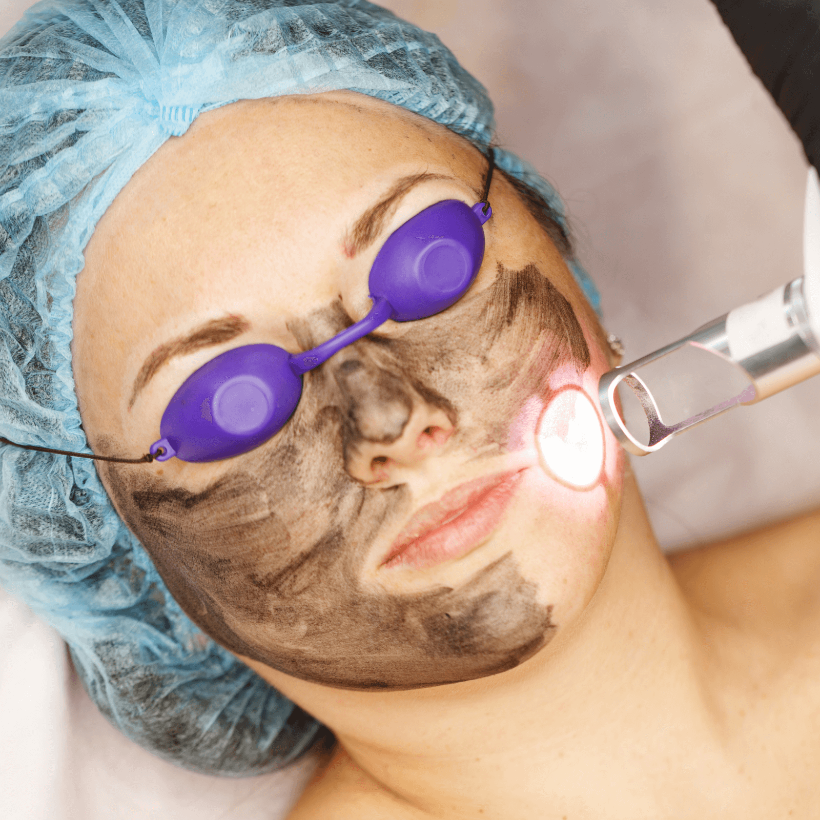 Laser Rejuvenation