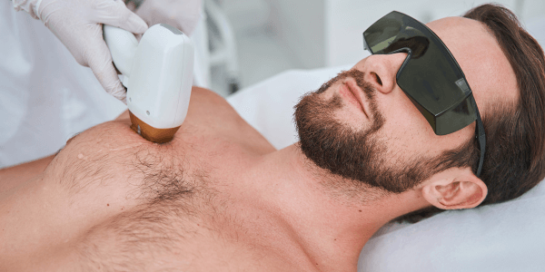 Best Laser Hair Removal Clinic In Gurgaon 3 Upper Body hair removal