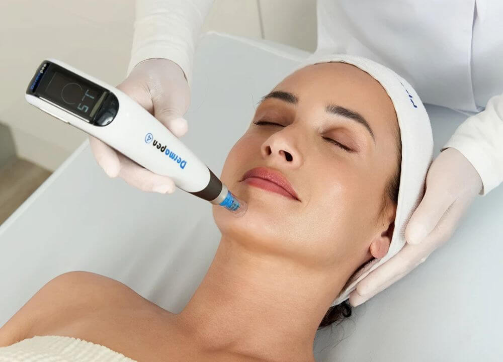 Microneedling Treatment in Gurgaon