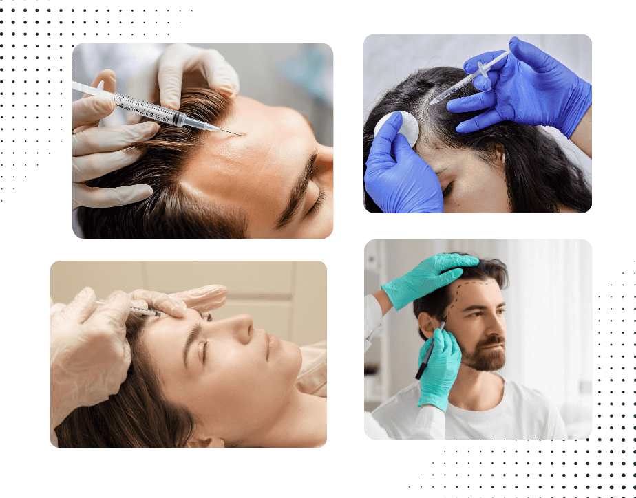 hair loss treatment in gurgaon