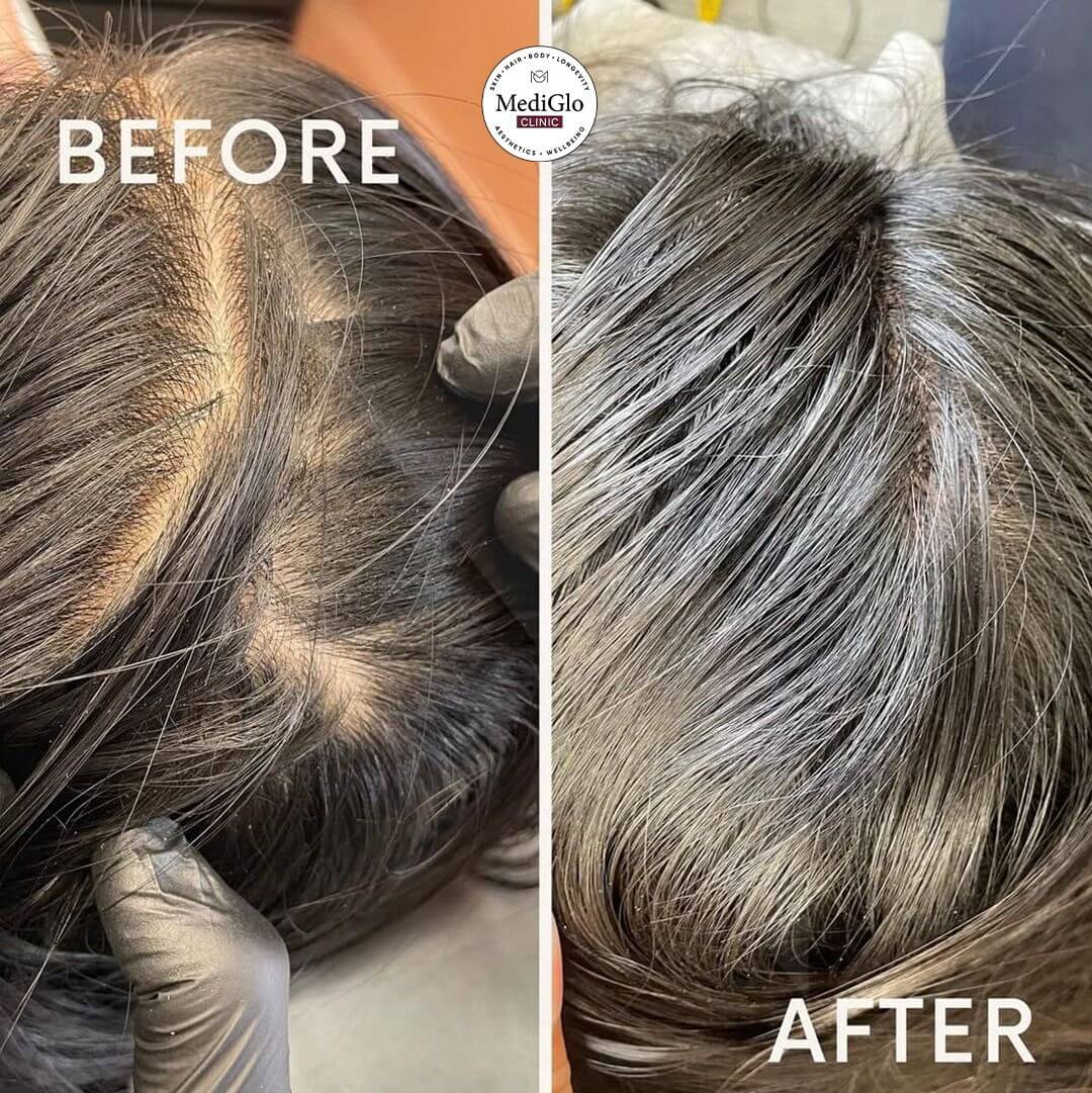 Hair LP Befor After Two