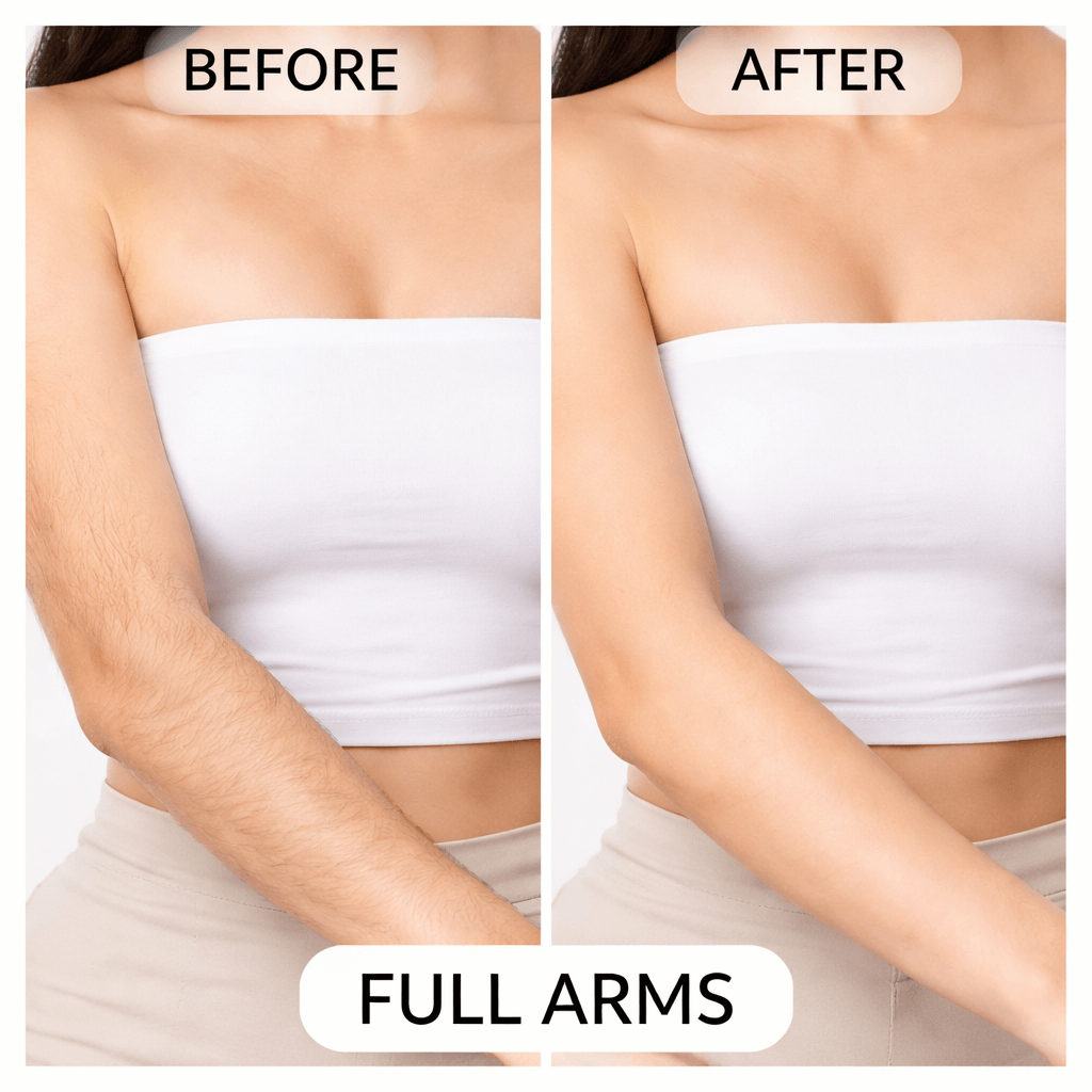 Arms LHR Before and After