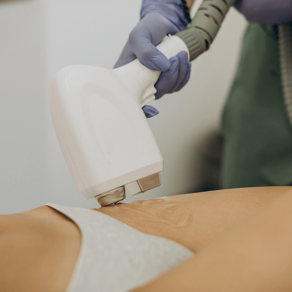 Bikni Area Laser Hair Reduction