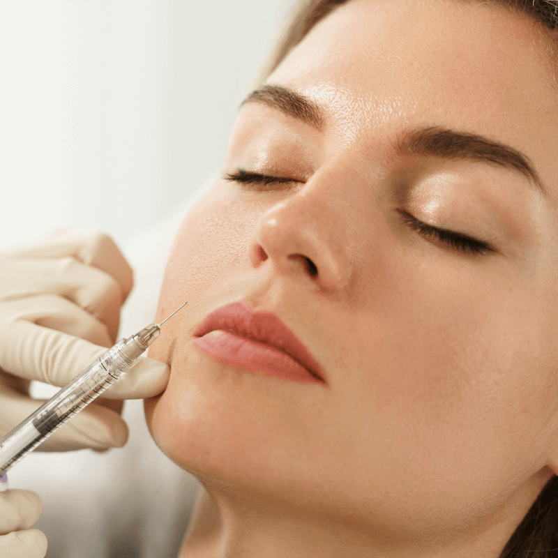 Dermal Filler Treatment