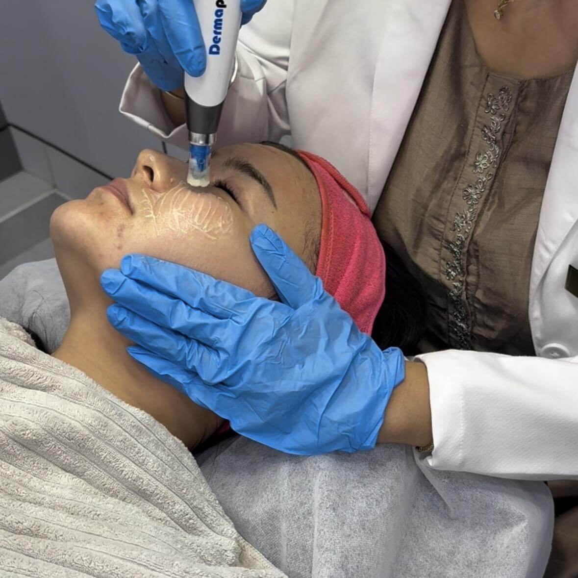 Dermapen 4 Anti aging treatment