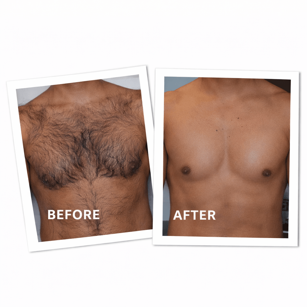Men Chest LHR Before and After