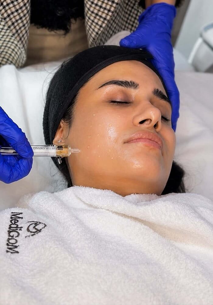 Collagen Induction Facial at Mediglo