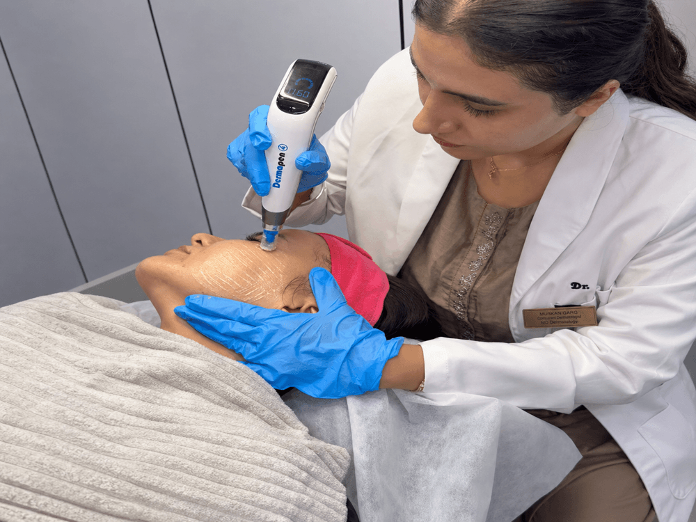 Dermapen 4 Treatment in Gurgaon at Mediglo