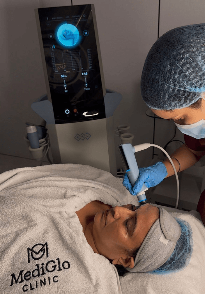 Exion Non Invasive Face Filler