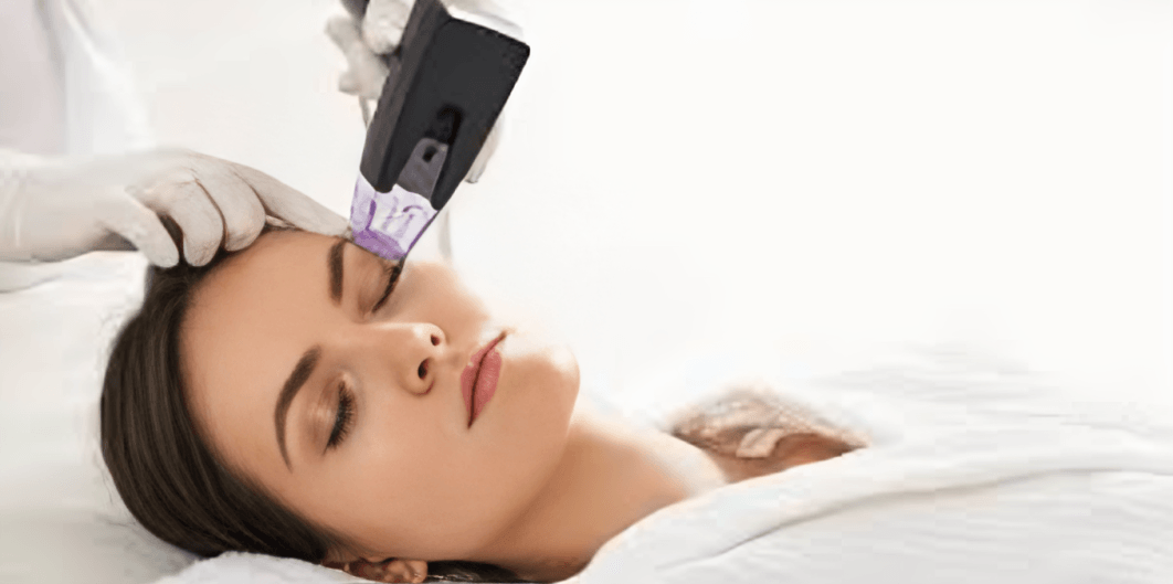 Morpheus 8 Treatment