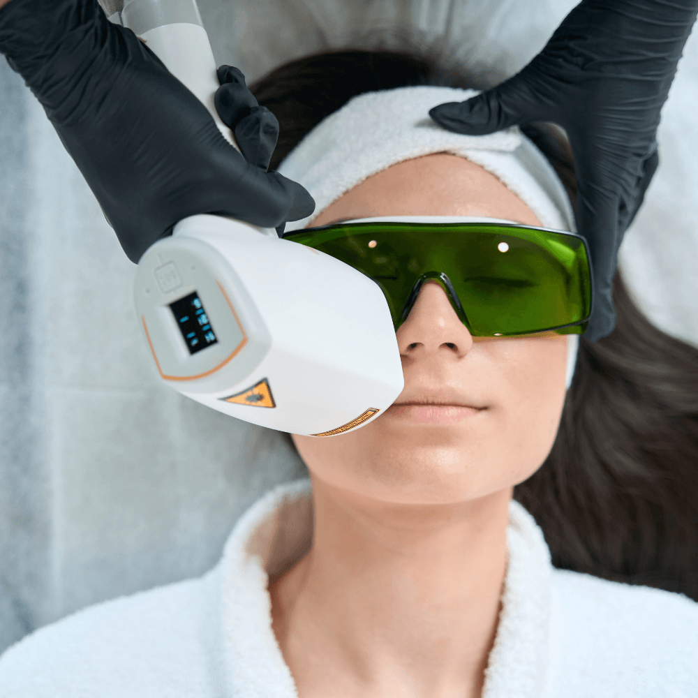 Facial Laser Hair Removal