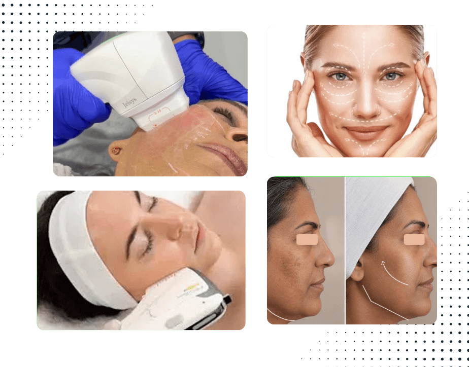 HIFU Treatment in Gurgaon 3 HIFU Treatment at Mediglo