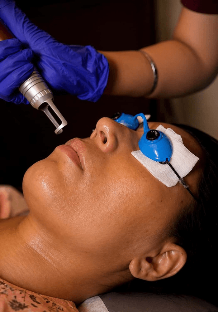 Q-Switch Face Toning at Mediglo