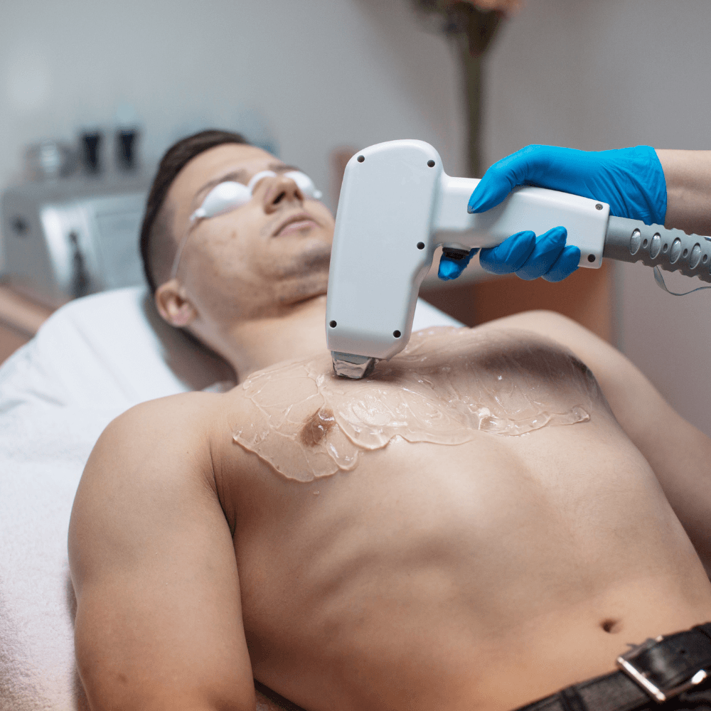 Upper Body Laser Hair Removal in Gurgaon