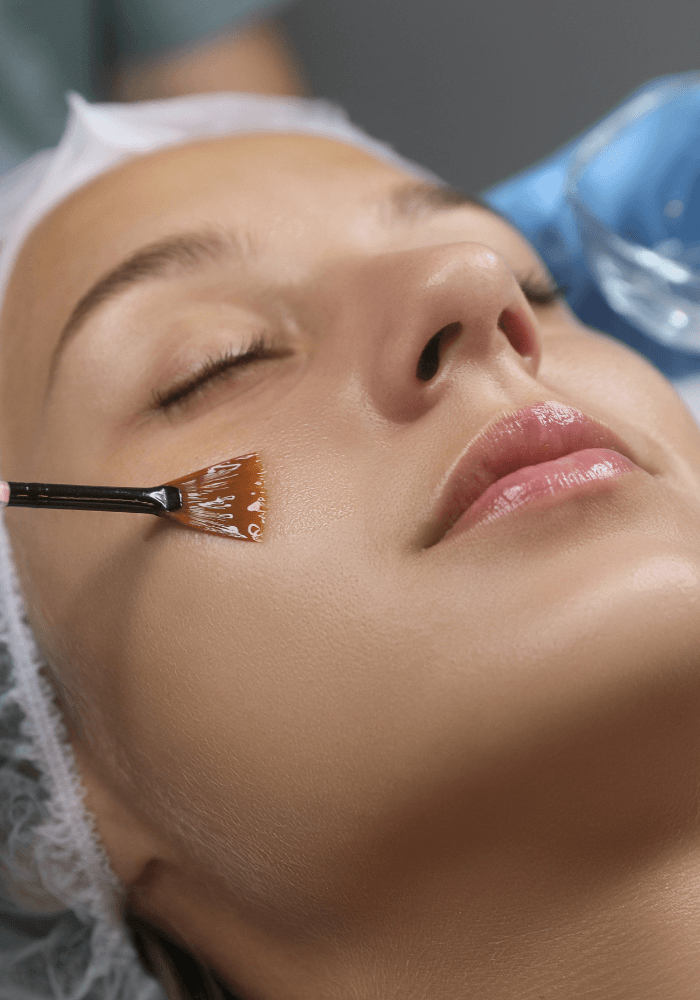 Chemical Peel The Anti-Aging Angle