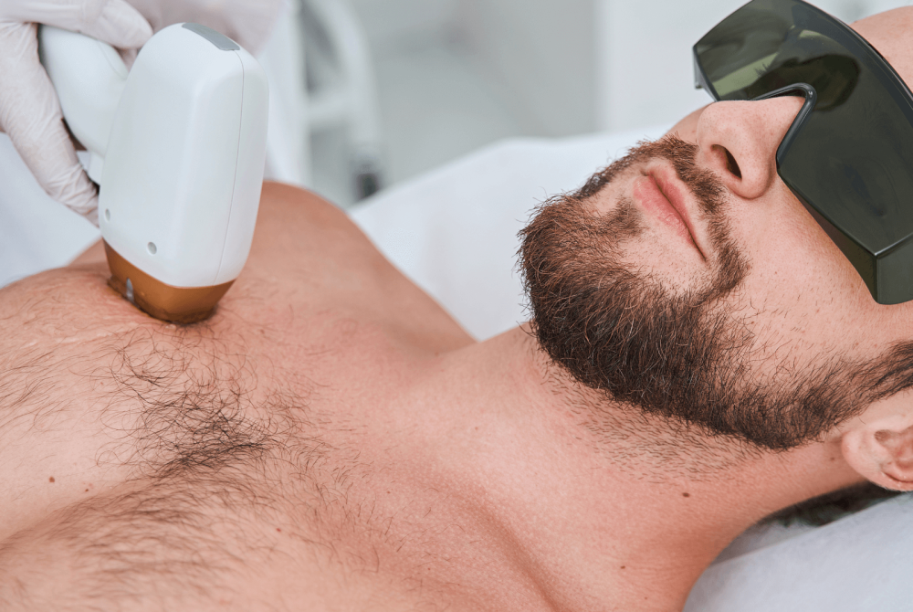 Laser Hair Reduction